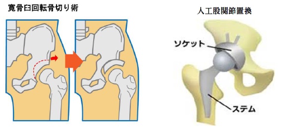 股関節痛　江南市　整体