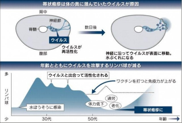 江南市　整体　帯状疱疹後神経痛