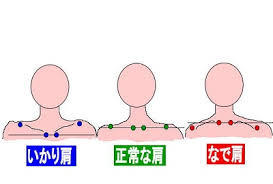 江南市　整体　江南健生堂　胸郭出口症候群