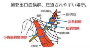 江南市　整体　江南健生堂　胸郭出口症候群