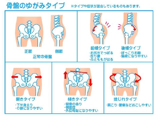 産後骨盤矯正　江南市　整体